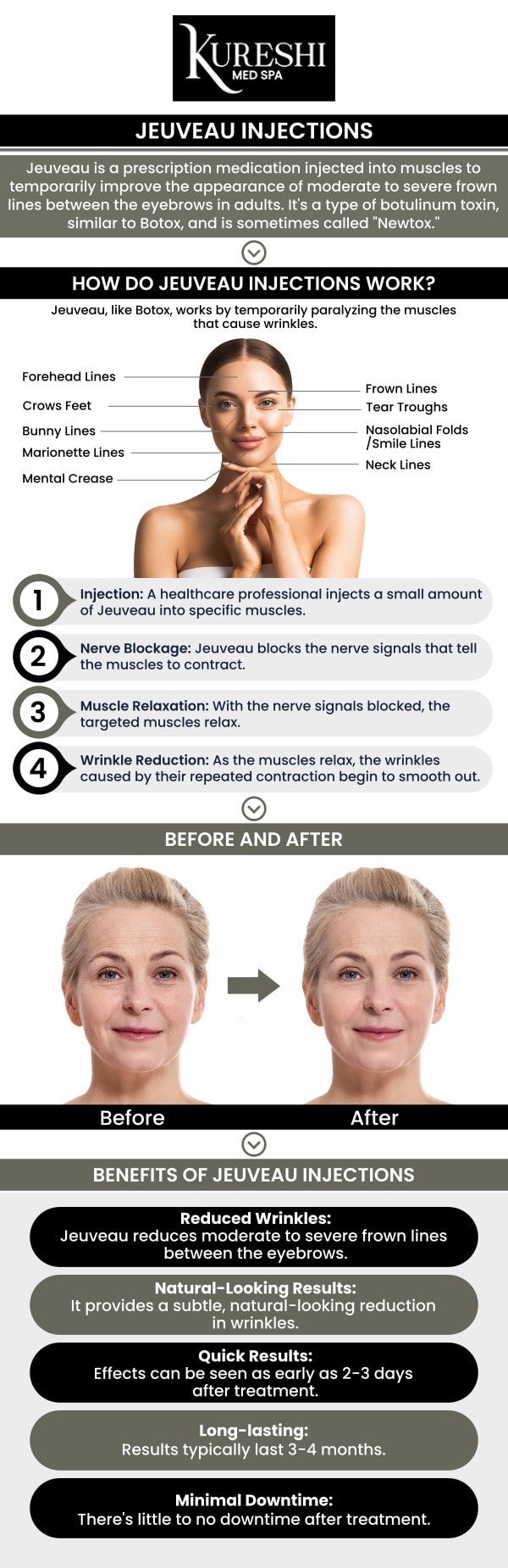 At Kureshi Med Spa, Dr. Ikram Kureshi offers personalized Jeuveau treatments to reduce the appearance of fine lines and wrinkles. The average cost of Jeuveau in McKinney, TX, ranges from $300 to $600 per treatment, depending on the number of units needed and the treatment area. For more information, contact us or book an appointment online. We are conveniently located at 5860 Collin McKinney Pkwy Suite 603, McKinney, TX 75070. At Kureshi Med Spa, Dr. Ikram Kureshi offers personalized Jeuveau treatments to reduce the appearance of fine lines and wrinkles. The average cost of Jeuveau in McKinney, TX, ranges from $300 to $600 per treatment, depending on the number of units needed and the treatment area. For more information, contact us or book an appointment online. We are conveniently located at 5860 Collin McKinney Pkwy Suite 603, McKinney, TX 75070.