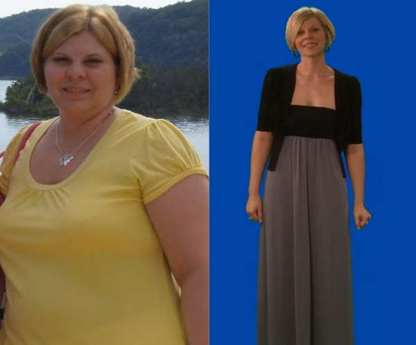 Weight Loss Treatment - Before and After Treatment at Kureshi Med Spa and Weight Loss in McKinney, TX Weight Loss Treatment - Before and After Treatment at Kureshi Med Spa and Weight Loss in McKinney, TX