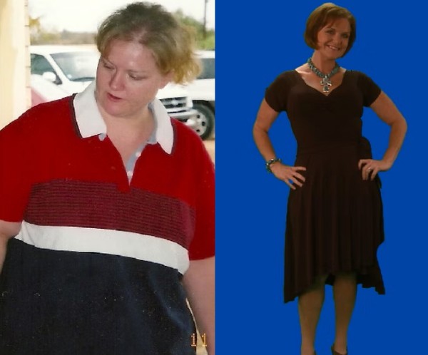 Weight Loss Treatment - Before and After Treatment at Kureshi Med Spa and Weight Loss in McKinney, TX Weight Loss Treatment - Before and After Treatment at Kureshi Med Spa and Weight Loss in McKinney, TX