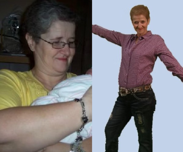 Weight Loss Treatment - Before and After Treatment at Kureshi Med Spa and Weight Loss in McKinney, TX Weight Loss Treatment - Before and After Treatment at Kureshi Med Spa and Weight Loss in McKinney, TX