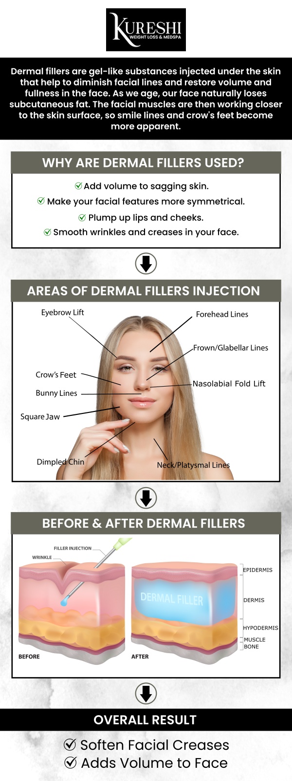 At Kureshi Weight Loss & Medspa, we believe in providing elite aesthetic results without hidden fees. The cost of dermal fillers in McKinney typically ranges based on the specific product used, such as Juvederm or Restylane, and the volume required to achieve your goals. During your consultation, Dr. Kureshi provides a customized quote tailored to your anatomy, ensuring you receive the most cost-effective plan for a youthful, refreshed appearance. For more information, contact us or book an appointment online. We are conveniently located at 5860 Collin McKinney Pkwy Suite 603, McKinney, TX 75070. At Kureshi Weight Loss & Medspa, we believe in providing elite aesthetic results without hidden fees. The cost of dermal fillers in McKinney typically ranges based on the specific product used, such as Juvederm or Restylane, and the volume required to achieve your goals. During your consultation, Dr. Kureshi provides a customized quote tailored to your anatomy, ensuring you receive the most cost-effective plan for a youthful, refreshed appearance. For more information, contact us or book an appointment online. We are conveniently located at 5860 Collin McKinney Pkwy Suite 603, McKinney, TX 75070.
