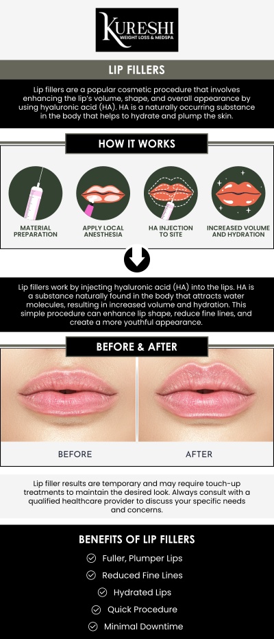 At Kureshi Weight Loss & Medspa, we believe that beautiful lips should look as natural as they feel. Using premium hyaluronic acid fillers like Juvederm and Restylane, Dr. Kureshi artfully enhances your smile by adding subtle volume and smoothing out fine vertical lines around the mouth. Whether you desire a dramatic transformation or a soft, hydrated refresh, our personalized approach ensures your results are balanced with your unique facial features. For more information, contact us or book an appointment online. We are conveniently located at 5860 Collin McKinney Pkwy Suite 603, McKinney, TX 75070. We serve clients from McKinney TX, Allen TX, Frisco TX, Plano TX, Melissa TX, Anna TX, Van Alstyne TX and Sherman, TX.